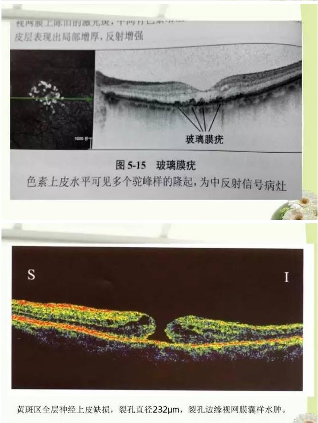 OCT����֪ʶ������֪���Ķ�������