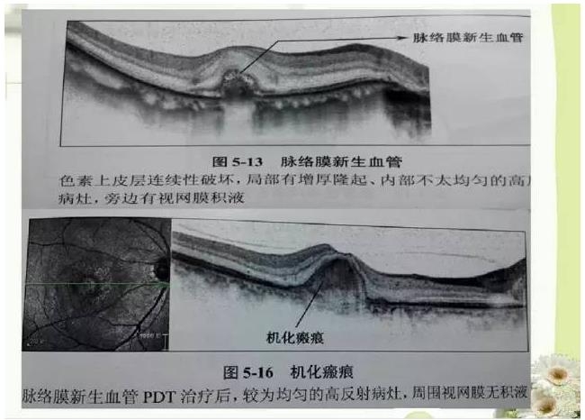 OCT����֪ʶ������֪���Ķ�������