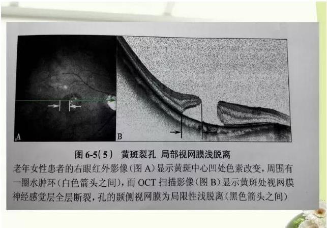 OCT����֪ʶ������֪���Ķ�������