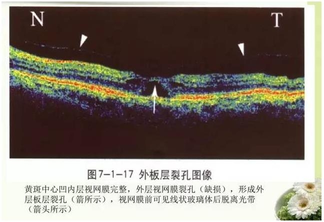 OCT����֪ʶ������֪���Ķ�������