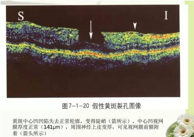 OCT����֪ʶ������֪���Ķ�������