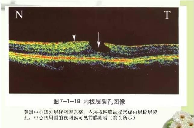 OCT����֪ʶ������֪���Ķ�������