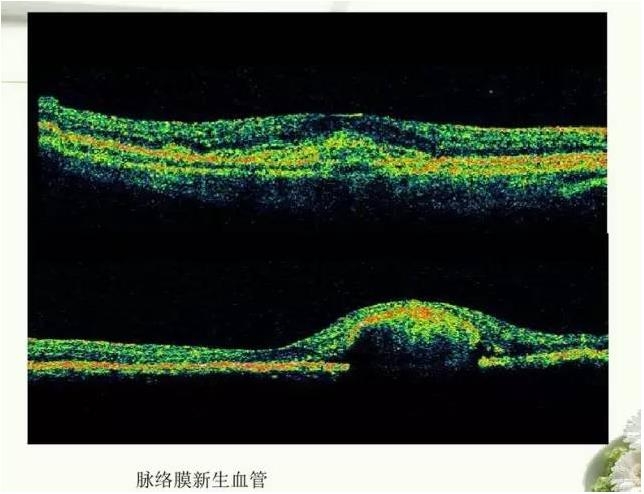 OCT����֪ʶ������֪���Ķ�������