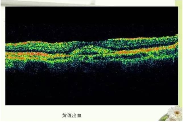 OCT����֪ʶ������֪���Ķ�������