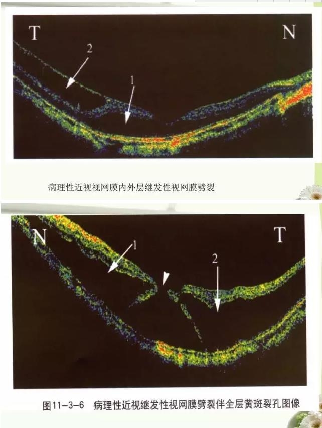 OCT����֪ʶ������֪���Ķ�������