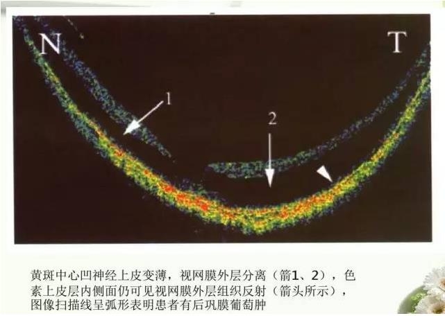 OCT����֪ʶ������֪���Ķ�������