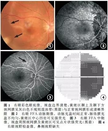 ��������������״�������Ĥ����һ��