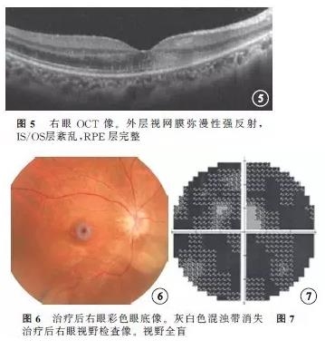 ��������������״�������Ĥ����һ��