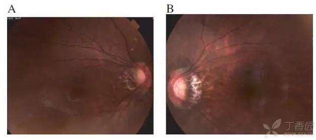 ��������3XȾɫ���ۺ�����߶Ƚ���