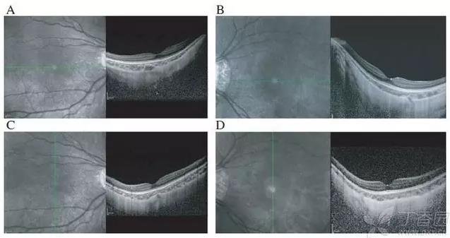 ��������3XȾɫ���ۺ�����߶Ƚ���