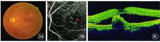 ��������������Ϣ��״����ĤѪ�ܲ���һ��