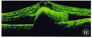 ��������������Ϣ��״����ĤѪ�ܲ���һ��