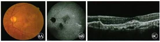 ��������������Ϣ��״����ĤѪ�ܲ���һ��