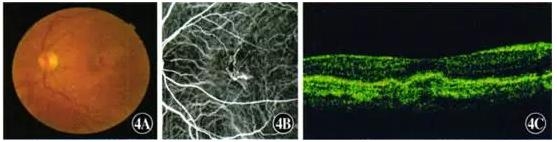 ��������������Ϣ��״����ĤѪ�ܲ���һ��