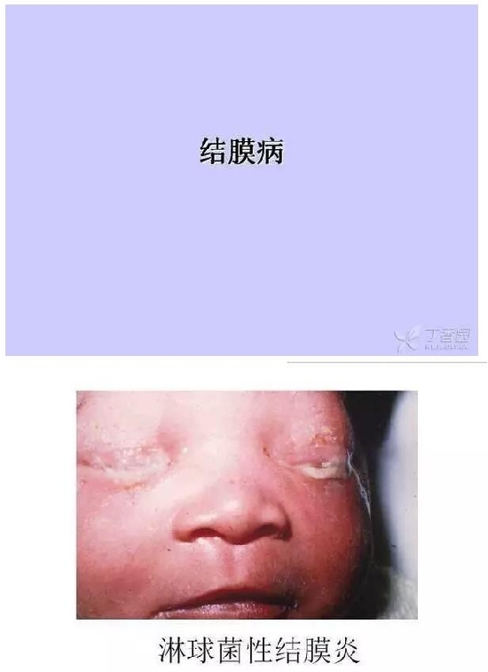 ��Ĥ�����Ĥ������ͼ��