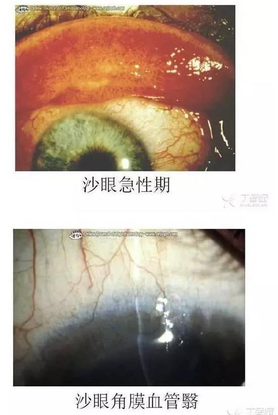 ��Ĥ�����Ĥ������ͼ��