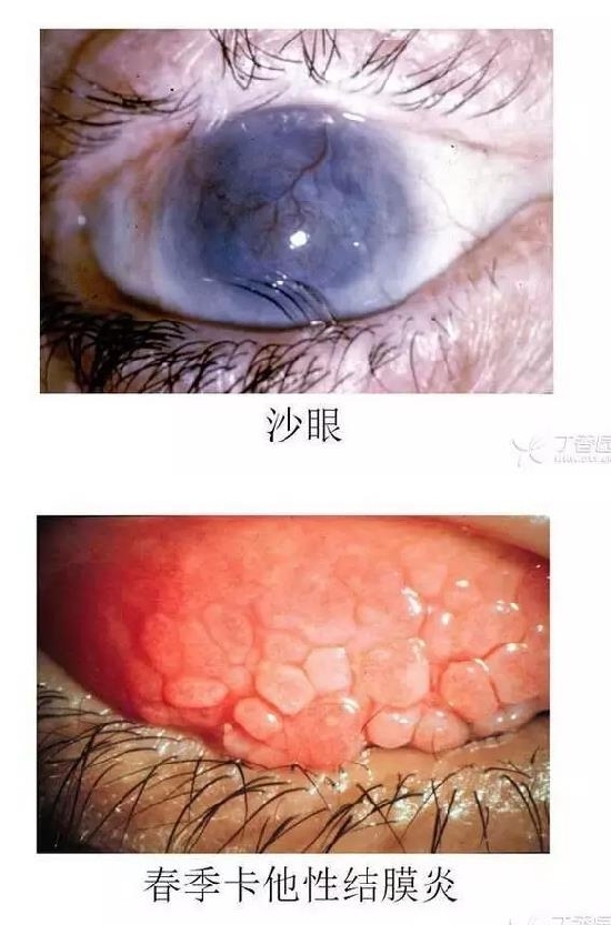 ��Ĥ�����Ĥ������ͼ��