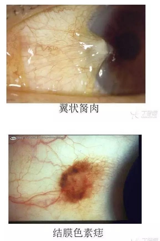 ��Ĥ�����Ĥ������ͼ��