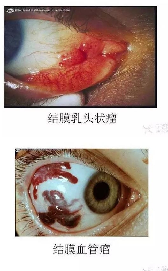 ��Ĥ�����Ĥ������ͼ��