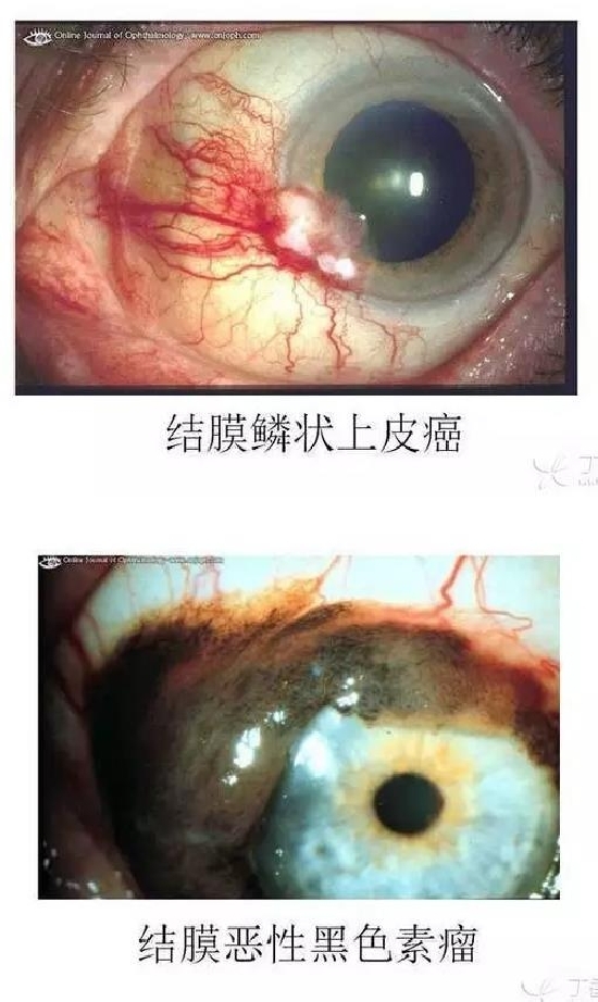 ��Ĥ�����Ĥ������ͼ��