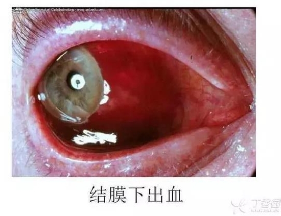 ��Ĥ�����Ĥ������ͼ��