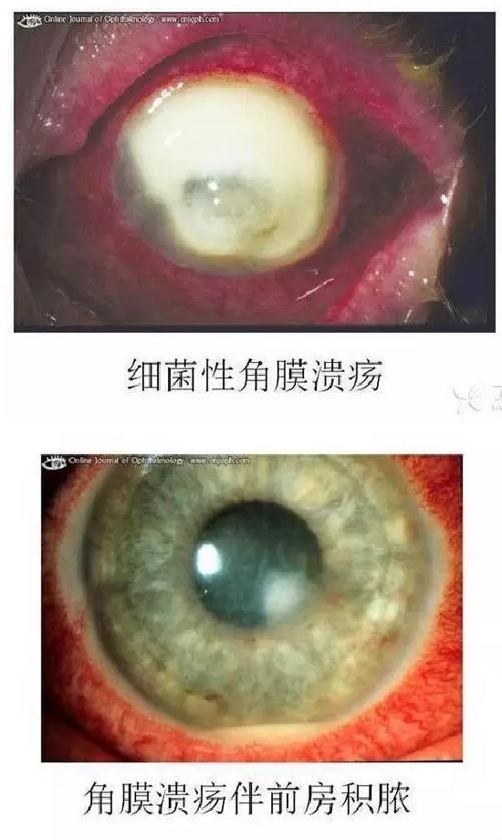 ��Ĥ�����Ĥ������ͼ��