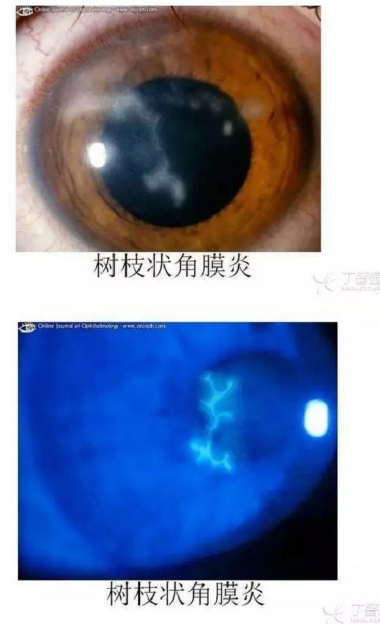 ��Ĥ�����Ĥ������ͼ��