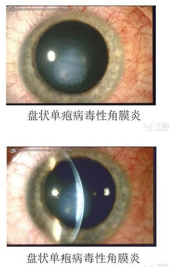 ��Ĥ�����Ĥ������ͼ��