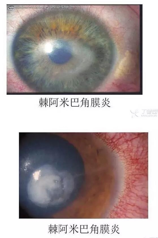 ��Ĥ�����Ĥ������ͼ��