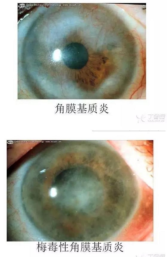 ��Ĥ�����Ĥ������ͼ��