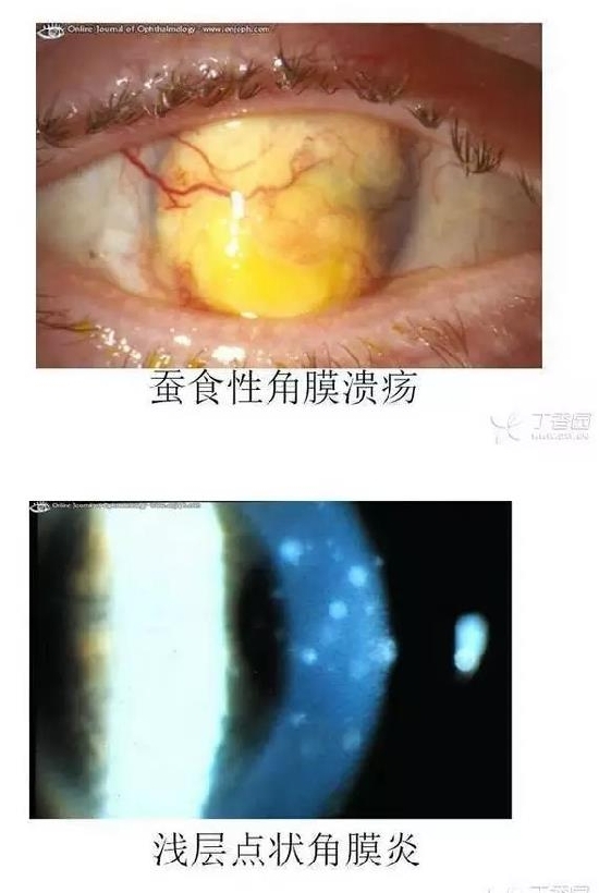 ��Ĥ�����Ĥ������ͼ��