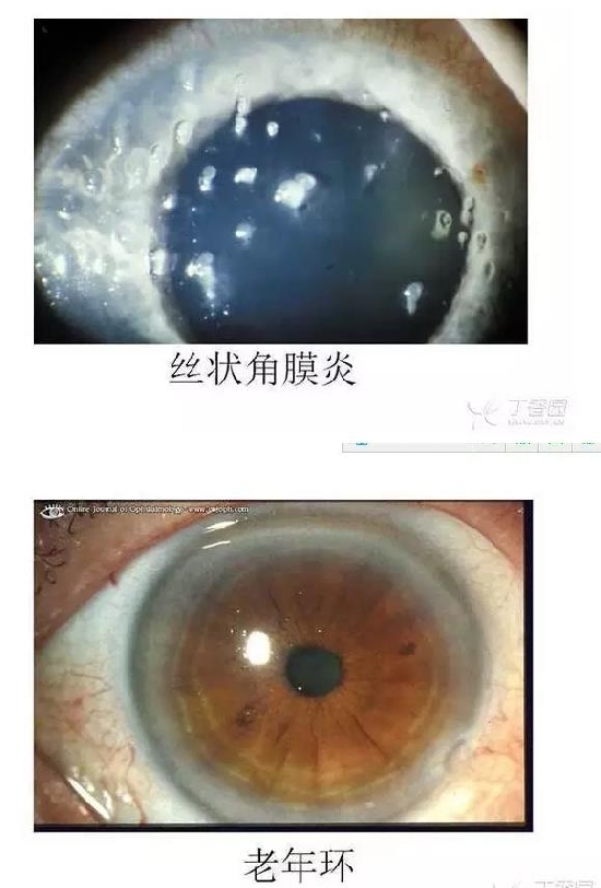 ��Ĥ�����Ĥ������ͼ��