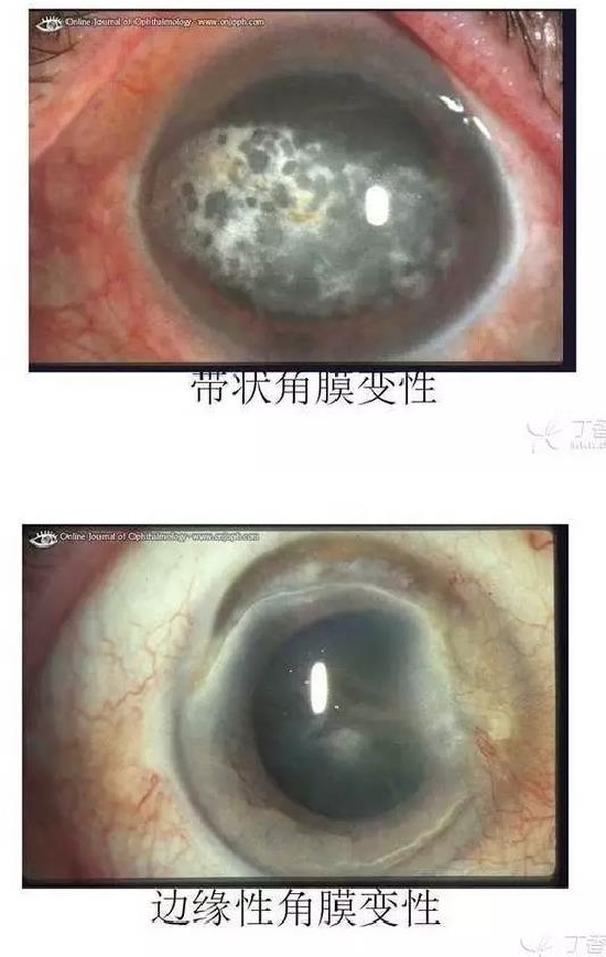 ��Ĥ�����Ĥ������ͼ��