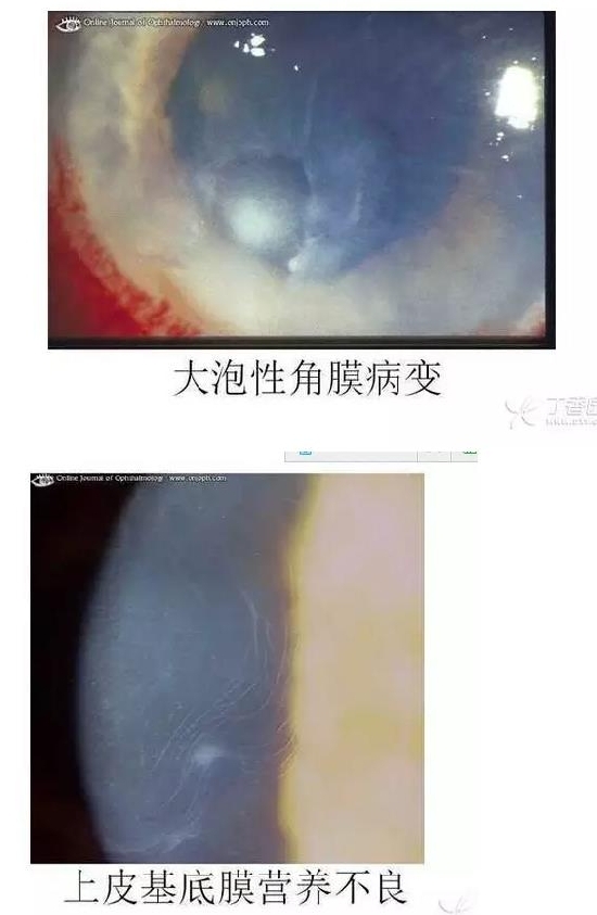 ��Ĥ�����Ĥ������ͼ��