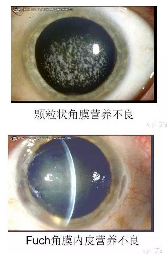 ��Ĥ�����Ĥ������ͼ��