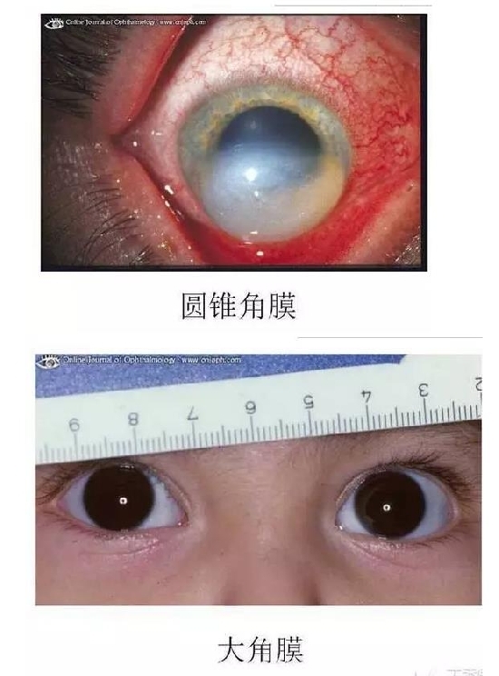 ��Ĥ�����Ĥ������ͼ��