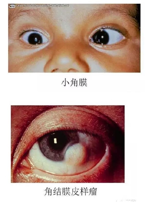 ��Ĥ�����Ĥ������ͼ��