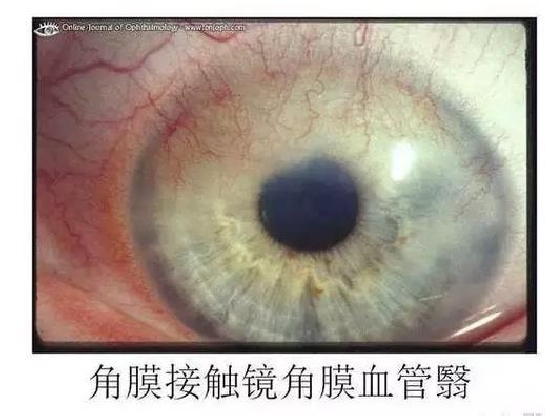 ��Ĥ�����Ĥ������ͼ��