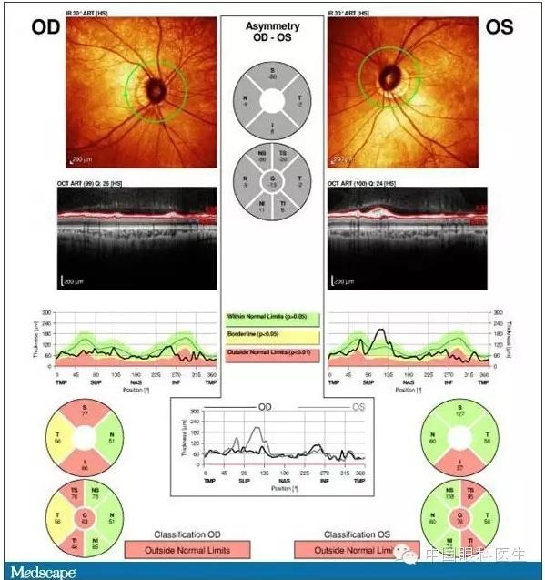 ��������������ѹ������������½�һ��