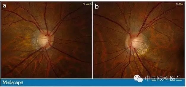 ��������������ѹ������������½�һ��