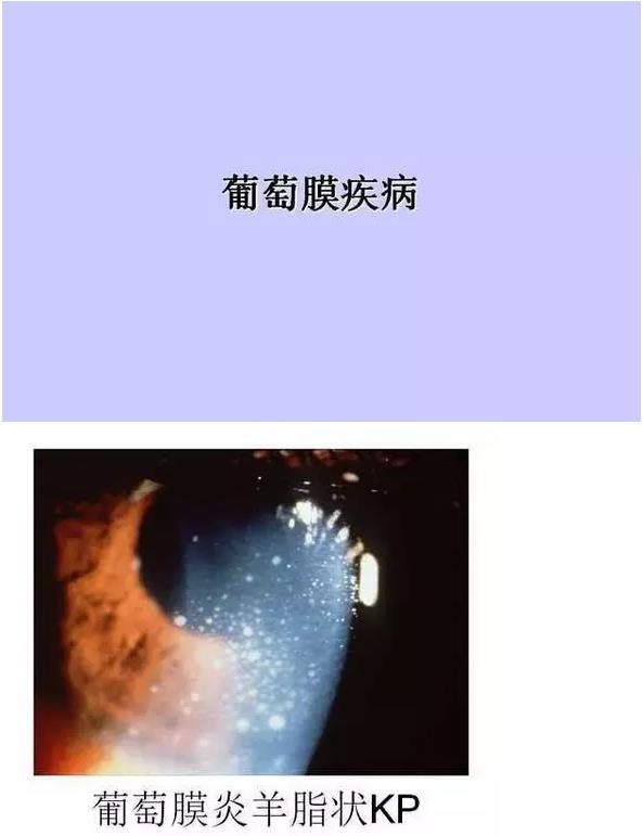 ����Ĥ����������Ĥ��������ͼ��