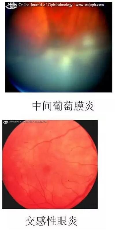 ����Ĥ����������Ĥ��������ͼ��