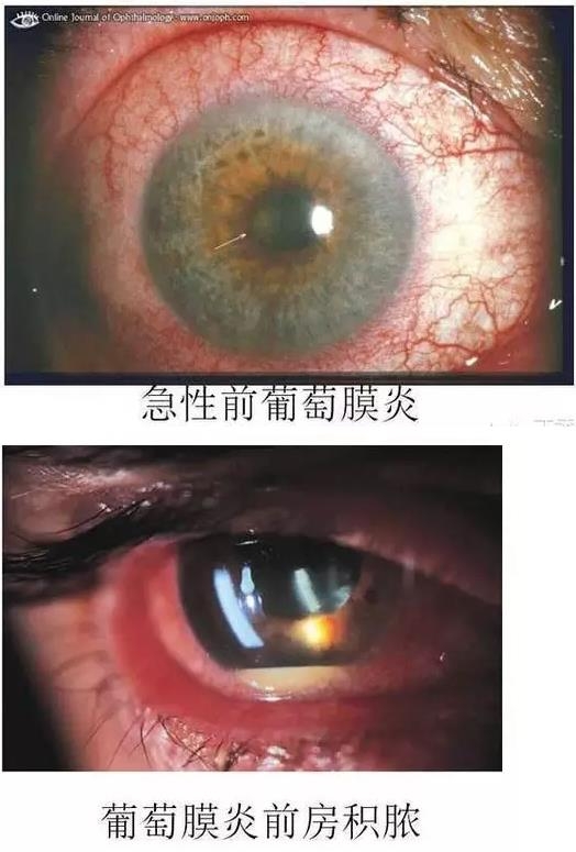 ����Ĥ����������Ĥ��������ͼ��