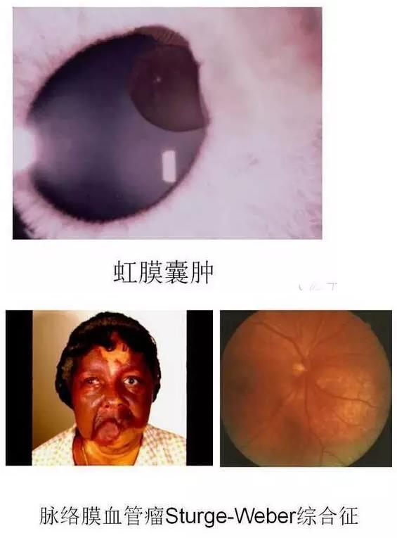 ����Ĥ����������Ĥ��������ͼ��