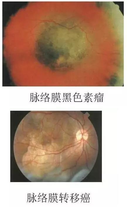 ����Ĥ����������Ĥ��������ͼ��