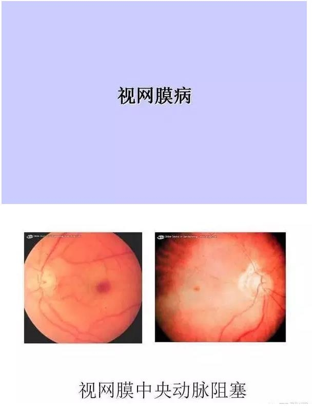 ����Ĥ����������Ĥ��������ͼ��