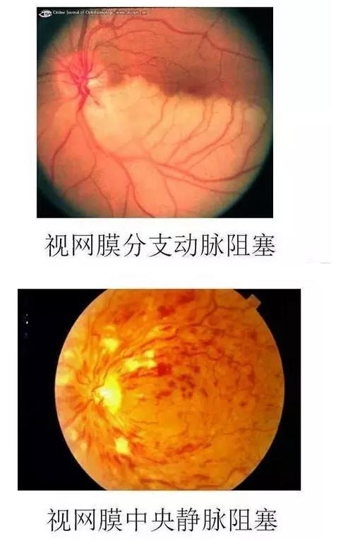 ����Ĥ����������Ĥ��������ͼ��