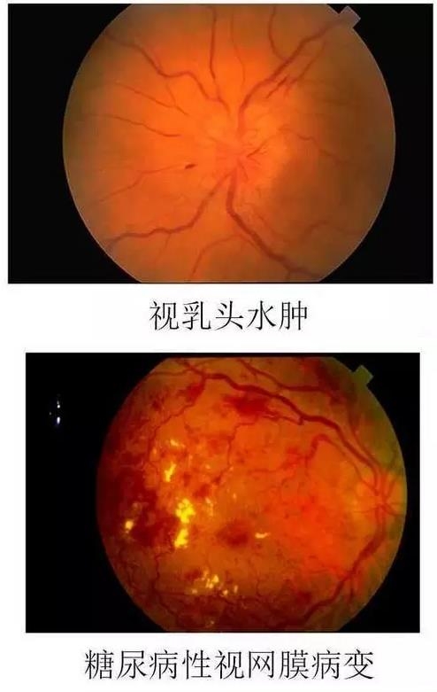 ����Ĥ����������Ĥ��������ͼ��