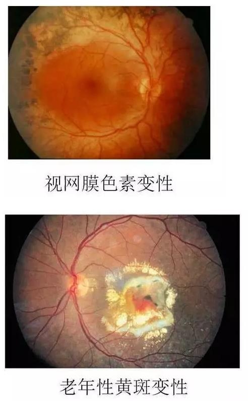 ����Ĥ����������Ĥ��������ͼ��