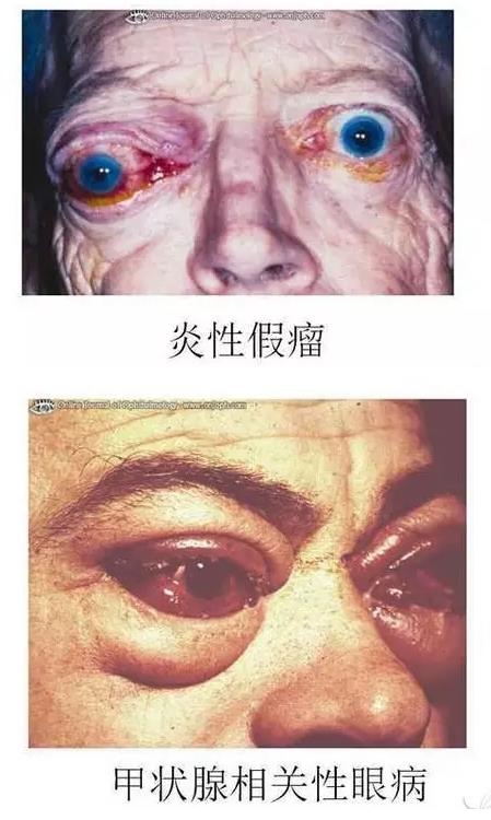 ����Ĥ����������Ĥ��������ͼ��